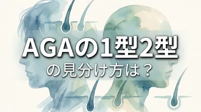 AGAの1型2型の見分け方は？