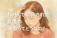 NHKで紹介された女性の薄毛ってどうなの？