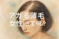 アガル薄毛女性って何？