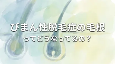 びまん性脱毛症の毛根ってどうなってるの？